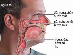Các phương pháp trị viêm mũi xoang hiệu quả 2