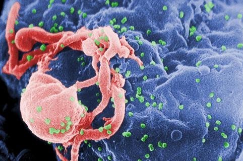 Thuốc điều trị ung thư có thể ngăn việc lây nhiễm HIV 1