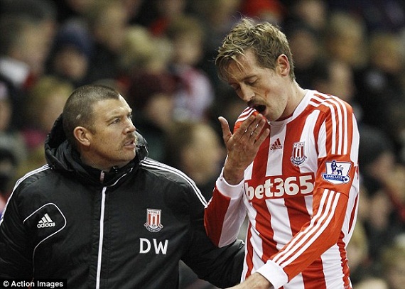 Peter Crouch gặp chấn thương 1