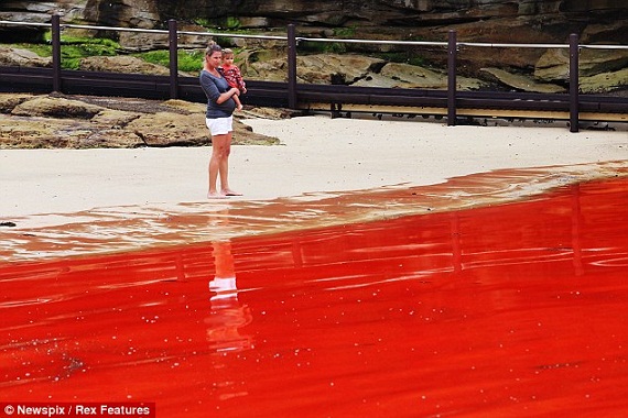 Bãi biển nổi tiếng Sydney bỗng hóa thành biển máu 3