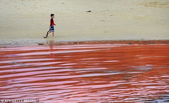 Bãi biển nổi tiếng Sydney bỗng hóa thành biển máu 4