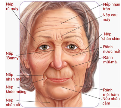 Chú ý: 9 nếp nhăn trên mặt cảnh báo bạn đang bị bệnh nguy hiểm