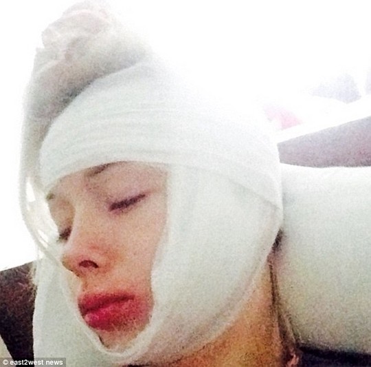 Valeria Lukyanova tuyên bố bị người lạ tấn công