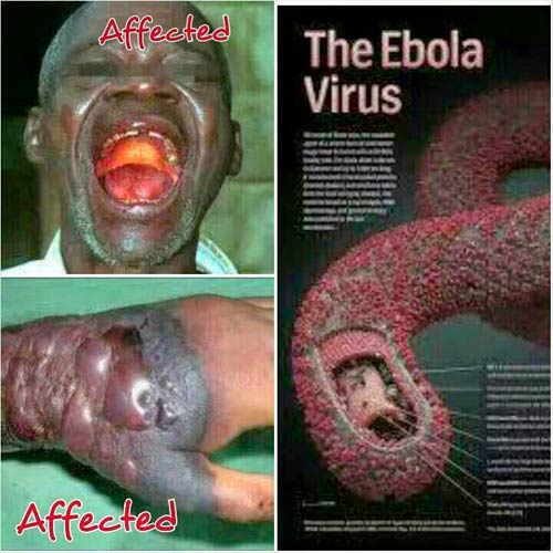 Vì sao ngay cả nhân viên y tế cũng chết vì virus Ebola?