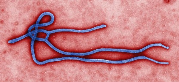 Dịch bệnh khủng khiếp Ebola có thể lan tới Việt Nam không? 2