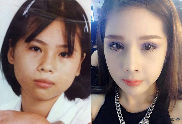 Hình ảnh Tina Lê trước và sau khi phẫu thuật thẩm mỹ 14 lần trong 10 năm.
