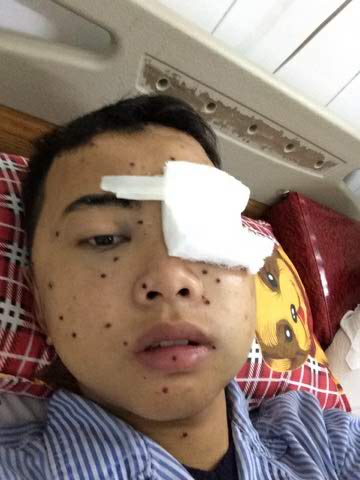 Cháu Trần Mạnh Cường bị 50 viên đạn chì  bắn vào mặt, vào đầu