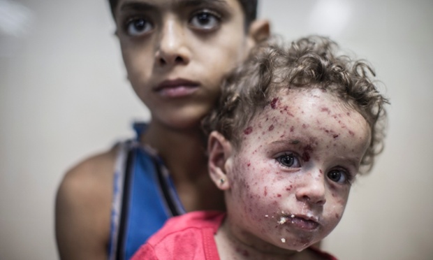 Cậu bé người Palestine ôm em gái tại phòng cấp cứu của bệnh viện Shifa ở thành phố Gaza. Bé gái bị trúng mảnh đạn pháo bắn ra từ xe tăng của Israel.