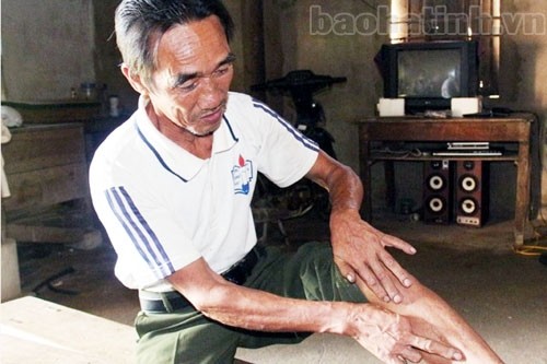 Thợ săn Nguyễn Đình Lục kể về lần bị trâu luông húc phải khâu 20 mũi.