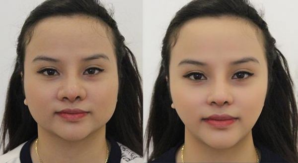 Soi ảnh con nít của các hot girl Việt đã công khai phẫu thuật thẩm mỹ 21