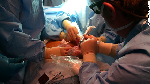 Phẫu thuật cho trẻ tránh các khuyết tật sau khi sinh mang nhiều rủi ro cao.