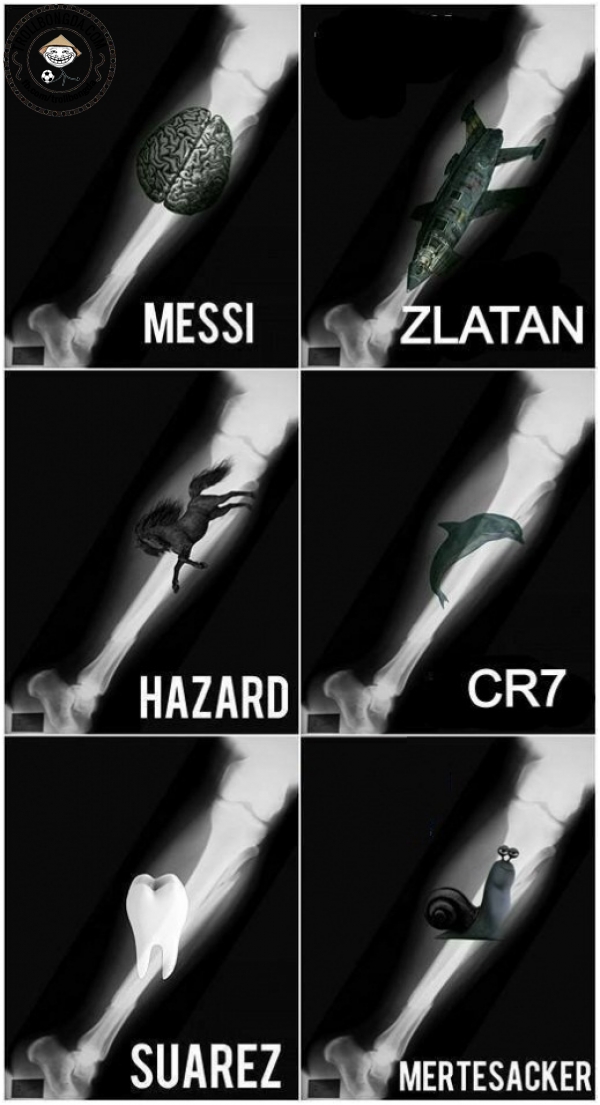 Chụp X-quang chân các cầu thủ