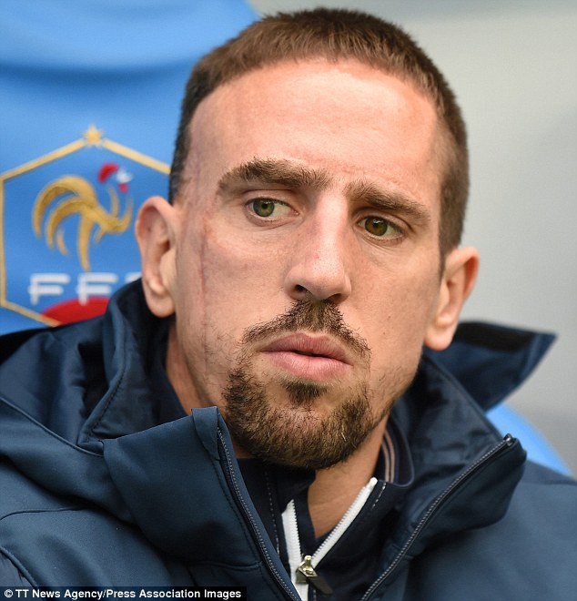 Sự vắng mặt của Ribery là tổn thất rất lớn của ĐT Pháp