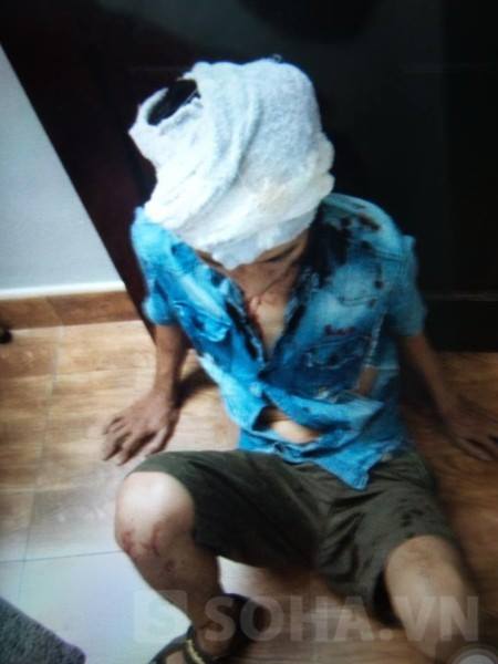Anh Ngô Văn Thùy, em trai ông Thuyên xuống căn ngăn đã bị đánh trọng thương ở phần đầu và tay (ảnh gia đình cung cấp, chụp tối hôm 25/7).