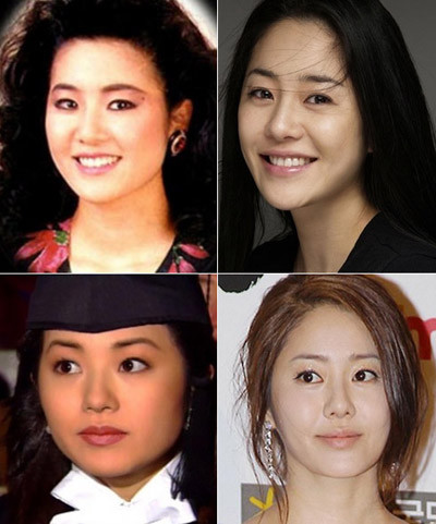 Á hậu 1 tại cuộc thi Miss Korea đã phải trải qua nhiều lần phẫu thuật.