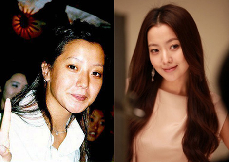 Kim Hee Sun và khuôn mặt già nua khi không trang điểm.