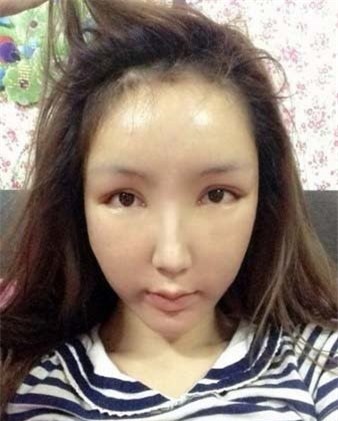 Một hot girl Trung Quốc đang khốn khổ vì lạm dụng phẫu thuật.