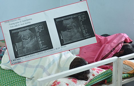 
Nhiều em gái trẻ đi phá thai ở cơ sở “chui”. Những cái thai đã 18-19 tuần tuổi vẫn được các phòng khám thai “chui” phá vô tội vạ. Ảnh: TÙNG SƠN
