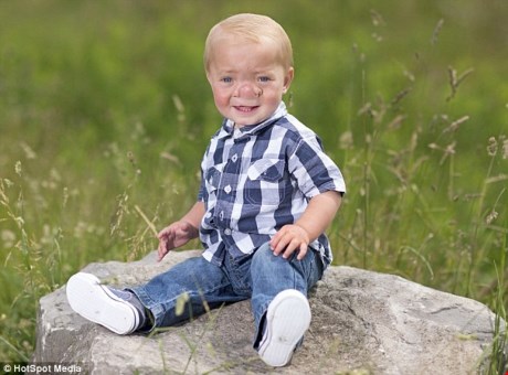 
Căn bệnh hiếm gặp khiến bé trai người Anh sinh ra với bộ não phát triển bên trong mũi.
