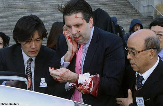 đại sứ Mỹ, tấn công, rạch mặt, dao, Hàn Quốc, thịt chó, bệnh viện