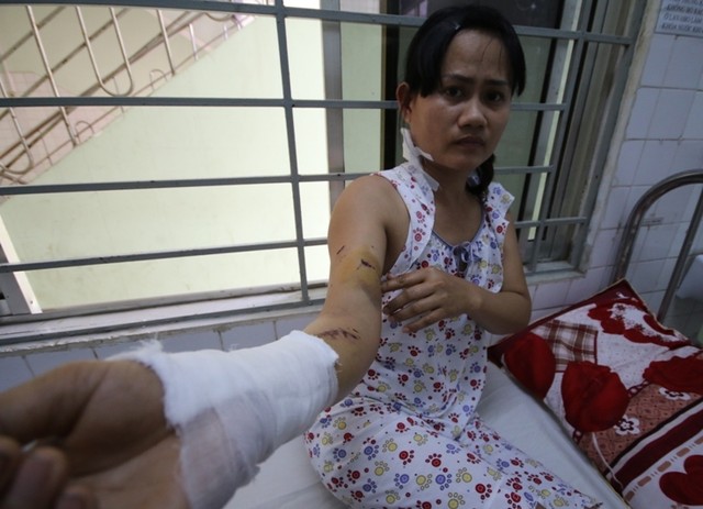 Chị Trần Thị Kế đang được điều trị tại BV Đà Nẵng