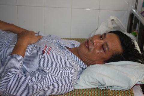 
Kỹ sư Trịnh Anh Tú bị các đối tượng hung hãn đánh gãy xương sườn.

