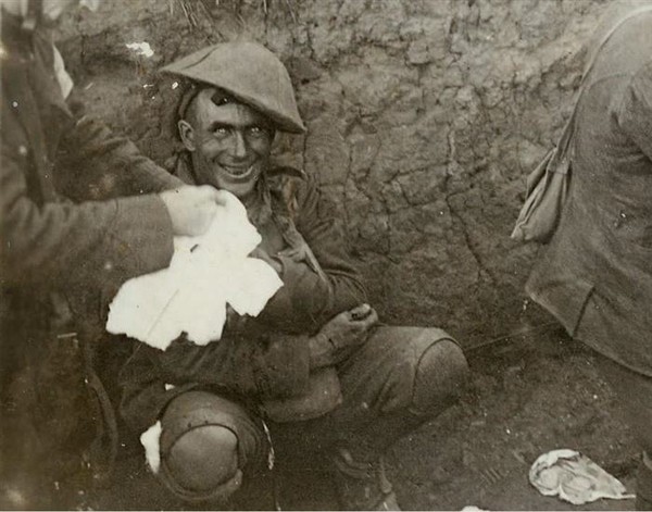 Đôi mắt điên dại- Người chiến binh này bị sốc do bom đạn nổ liên tiếp gây chấn thương thần kinh dẫn đến mất trí, mất ngủ, mất khả năng nói chuyện hay đi lại. Bức ảnh được chụp vào năm 1916 trong Chiến dịch Courcelette, Pháp.