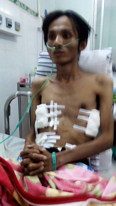 Đến hôm 24 Tết, Thái Lan Viên nhập viện trong tình trạng phải thở bằng oxy.