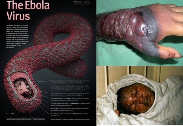 Đại dịch ebola hoành hành ở Tây Phi