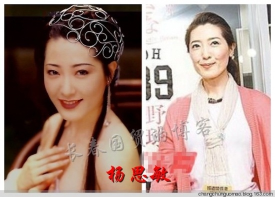 
Dương Tư Mẫn từng nổi tiếng màn ảnh Hong Kong với loạt phim Kim Bình Mai, tuy nhiên năm 1999, cô phải bỏ dở tất cả để điều trị căn bệnh ung thư vú. Sau lần phẫu thuật cũng như theo thời gian nhan sắc, vẻ đẹp nóng bỏng của cô không còn hoàn hảo như xưa.
