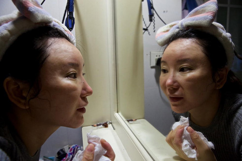 Sau phẫu thuật, cô bị dị ứng khiến mũi biến dạng, môi lệch và khuôn mặt sưng vù