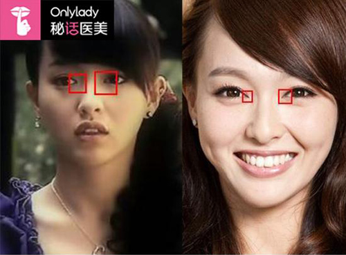 Hình ảnh so sánh cho biết Đường Yên đã chỉnh sửa mắt để có đôi mắt to và đẹp hơn.
