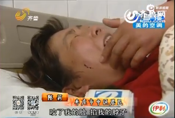 Một vết cắn khác mà Wu để lại trên má nạn nhân Chen.