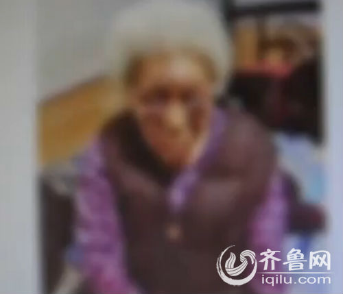 
Cụ bà 83 tuổi bị đánh thâm tím mặt.
