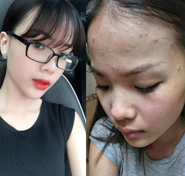 Khám phá hình ảnh đặc biệt về những mẫu henna đẹp mắt một cách không ngờ. Dành cho những ai yêu thích nghệ thuật trang trí tay đầy sáng tạo nhưng cần cẩn trọng với dị ứng henna.