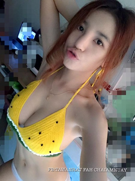 Hot girl Thai hoa “mat quy” vi su co tiem silicon 