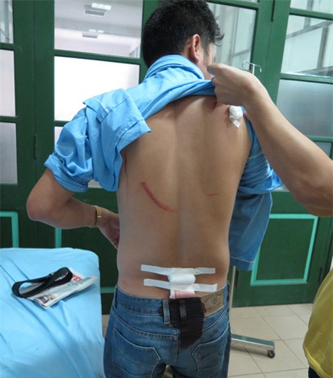 Những vết thương trên người nhà báo Nguyễn Ngọc Quang