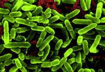 Trực khuẩn mủ xanh (Hình minh họa: Internet)