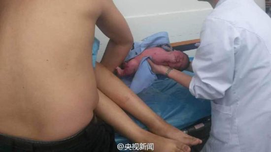 Sau khi đỡ để cho người phụ nữ, anh Xu đã dùng cao của mình để bọc cho đứa trẻ mới chào đời.