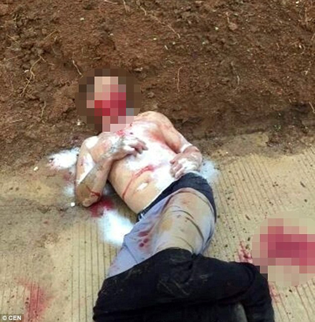
Một tên trộm bị xát muối vào vết thương chảy máu và chết sau khi xe cứu thương tới.
