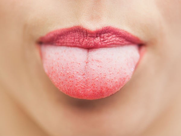 
Màu sắc lưỡi thay đổi: Nếu màu lưỡi chuyển sang vàng, hơi xanh hoặc trắng thì điều này đồng nghĩa với việc máu đang chứa không ít chất độc.
