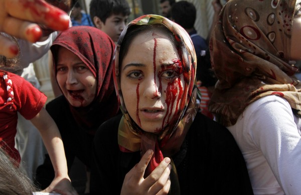 
Phụ nữ ở Syria cũng không thể tránh được tình trạng đổ máu tồi tệ như thế này do cuộc nội chiến. Ở đây, nguy cơ bị thương và mất tính mạng là không thể tránh khỏi.
