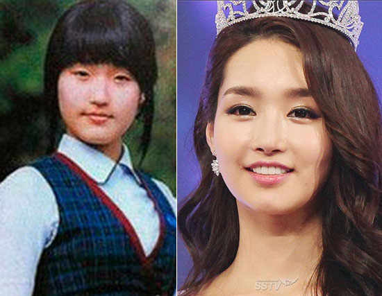Người đẹp sinh năm 1990 Kim Yu Mi đã vinh dự đăng quang Hoa hậu Hàn Quốc năm 2012. Vẻ đẹp ngọt ngào, nụ cười tươi tắn của Kim Yu Mi khác biệt so với ảnh xấu tệ thời đi học.