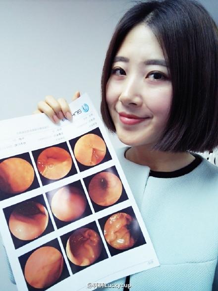 
Hàn Hàn cùng tấm hình chụp nội soi dạ dày của cô nàng.
