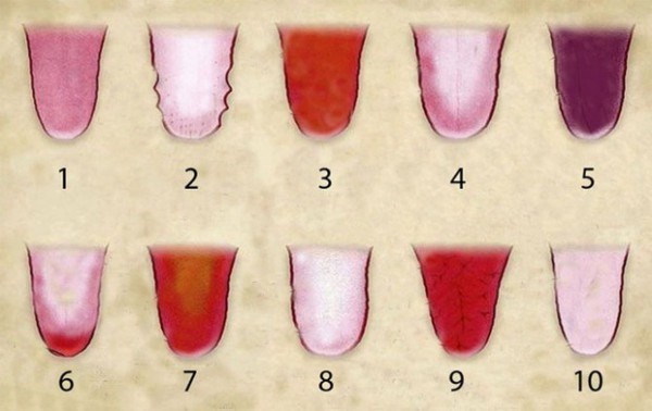 10 biểu hiện màu sắc của lưỡi thể hiện tình trạng sức khỏe.