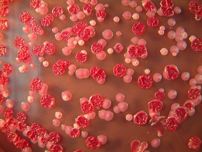 Vi khuẩn nguy hiểm Burkholderia pseudomallei dưới kính hiển vi