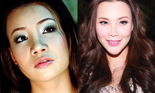Khuôn mặt Hồ Quỳnh Hương trước và sau khi phẫu thuật thẩm mỹ.
