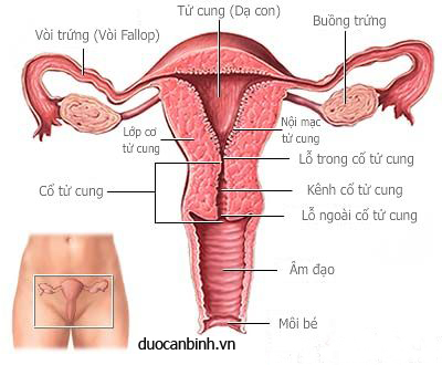 Lạc nội mạc tử cung có thể biến chứng thành vô sinh.