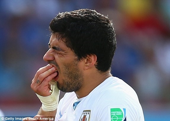 Khi Suarez ngứa răng, mọi thứ rất khó lường