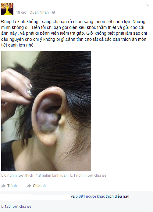 Hình ảnh trên Facebook cảnh báo về chứng bệnh lạ của một bạn nữ sau khi ăn tiết canh (Ảnh: FB nhân vật)